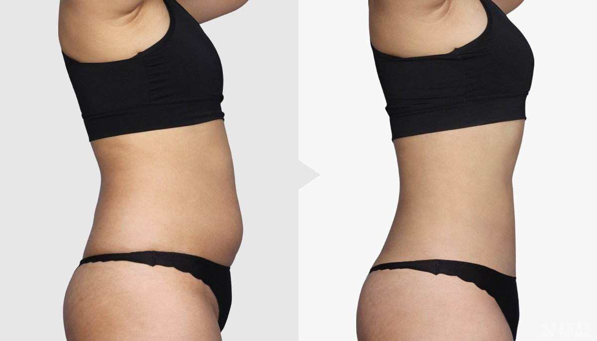 2023黃石玻尿酸原液正規(guī)醫(yī)生評分前幾(彭靜、楊天赤、步長龍等都是不錯的醫(yī)生！)