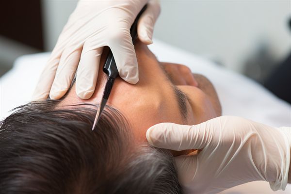 長沙法令紋玻尿酸填充專家推薦：十大名醫(yī)精挑細(xì)選！