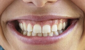 2023鄭州水動力抽脂瘦小腿前十名專家(趙維亞、徐海坤、程書信整友都說技術(shù)好)