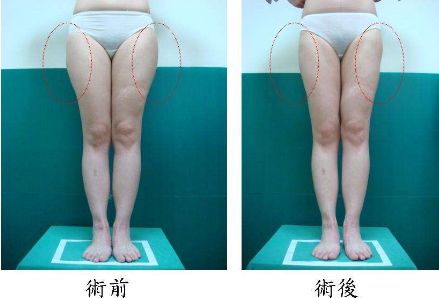 昆明哪家治痘痘好的醫(yī)院，痘痘問題如何有效解決？