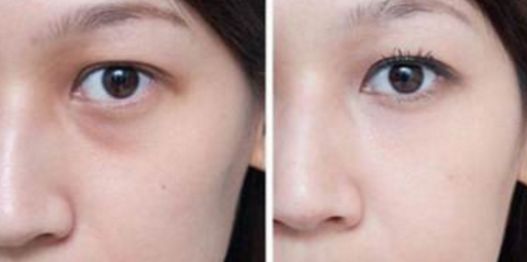 武漢看胎記醫(yī)院哪家好？綜合醫(yī)療機(jī)構(gòu)排行榜詳細(xì)解讀