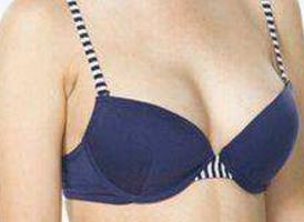 2023長沙手術祛除眉間紋前10強的專家(李平珍、張峰、向才錦這些醫(yī)生口碑靠前)