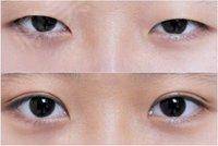 2023成都射頻祛靜態(tài)紋權(quán)威醫(yī)生排行前10名(汪國義、藍安惠、陳衛(wèi)華嚴選專家，實力過硬！)