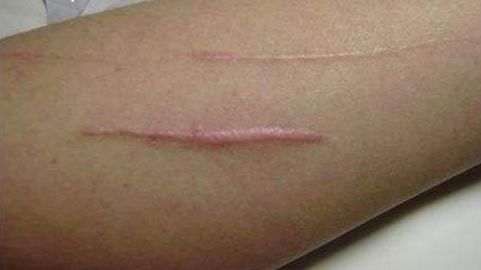 上海韓嘯醫(yī)療美容醫(yī)院的豐胸技術(shù)靠譜嗎？