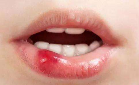 2023廈門玻尿酸去眼周紋專家排行十強(qiáng)(徐江萍、江碧川、徐江萍實(shí)力公布！)