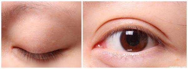 2023昆明隔空溶脂瘦肩部醫(yī)生top10強(qiáng)排名(李明、唐欽、任德浩榜首屬實意外)