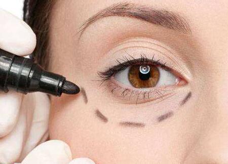 蘇州哪位醫(yī)生修復(fù)雙眼皮失敗靠譜？案例分享有人氣！