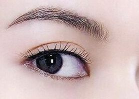 南充去眼袋哪家醫(yī)院好？專家推薦解決眼袋困擾的南充醫(yī)院排行榜