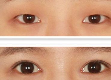 鄭州哪家美容醫(yī)院正規(guī)且口碑好？