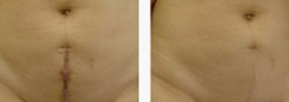 深圳私密整形醫(yī)院哪家好？讓我們來為您推薦最佳選擇