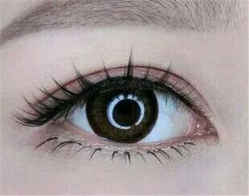 廣州王旭彬鼻子整形效果揭秘，與真人照片對比，令人驚艷的側(cè)顏！