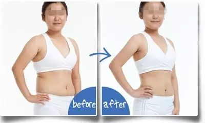 2023成都抽脂隆胸整形上榜清單前十名專(zhuān)家(秦曉、鄧兵、賈映缽價(jià)格不貴口碑好)