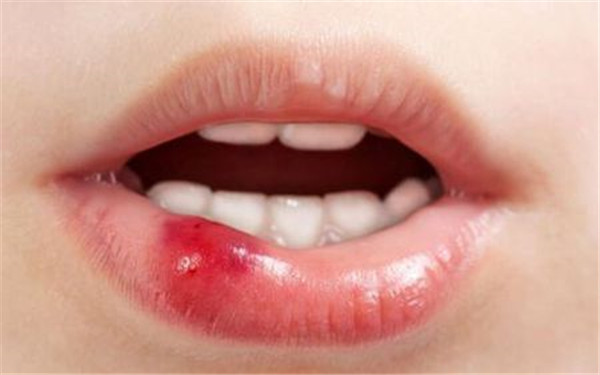 2023南京冷凍溶脂瘦后背專家排行榜前幾(董欣、郝超、朱臺航口碑技術(shù)令人稱贊)