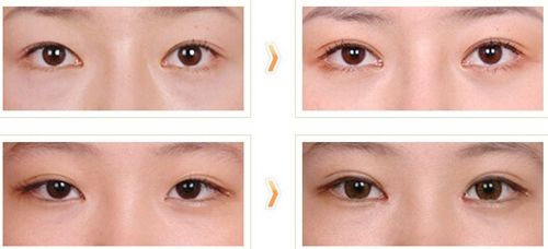 2023杭州瘦腿針注射醫(yī)生排名10強(qiáng)(劉洋、程麗、陳笑獲得網(wǎng)友極力推薦)