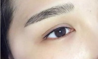 北京有口碑非常好的整形醫(yī)生推薦，綜合評(píng)分高，做吸脂效果優(yōu)異的名醫(yī)TOP5