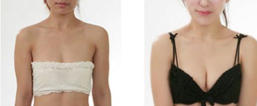 大連市做雙眼皮哪家好？了解大連市雙眼皮手術的費用、效果和口碑