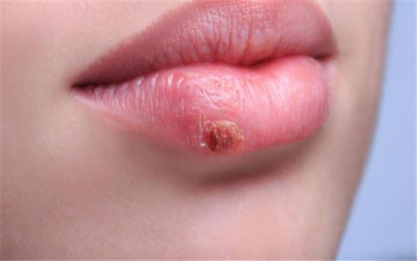 2023河南消除額頭紋專家排行前十(茹江江、朱卉、張會(huì)霞排行榜前三名官方認(rèn)證！)