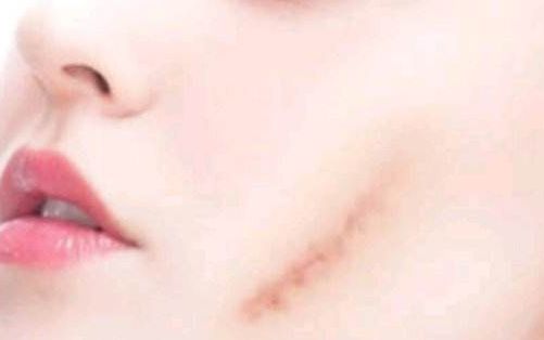 濰坊哪家醫(yī)院做抽脂整形好，服務(wù)好口碑好？