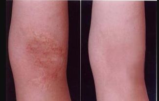 洛陽哪家醫(yī)院減重手術(shù)好？選醫(yī)院需注意哪些關(guān)鍵點(diǎn)？