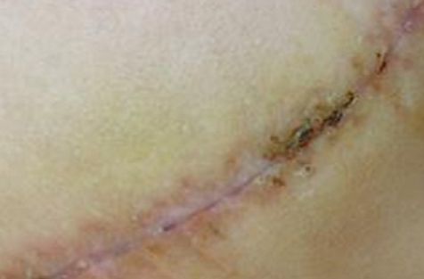 重慶去斑好的醫(yī)院哪家好？權(quán)威推薦，告訴您重慶著名的去斑治療醫(yī)院!