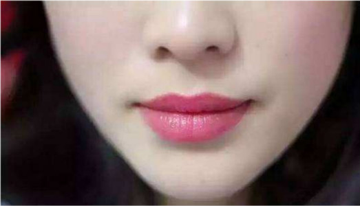 2023廈門深皺紋修復權(quán)威專家排名榜前10名(陳麗紅、殷佳鵬、廖卿德醫(yī)生大咖口碑推薦)