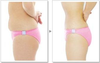 您在武漢協(xié)和醫(yī)院可以找到熱瑪吉嗎？預(yù)約技術(shù)嫻熟的醫(yī)生，口碑非常好！