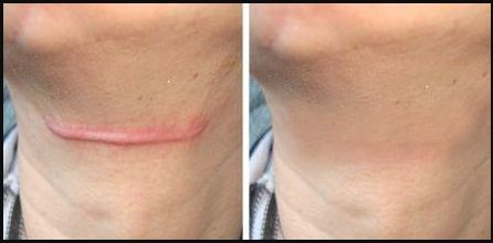 南京哪家私密醫(yī)院做得最好？來(lái)一探究竟！