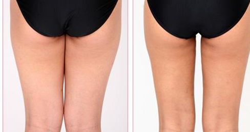 桂林私立醫(yī)院推薦，哪家好？2023最新排名解析