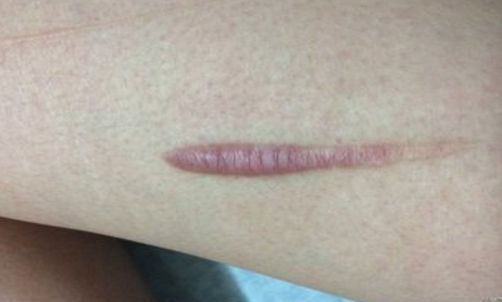 【2023年揚(yáng)州雙眼皮正規(guī)醫(yī)院排行榜公布！最靠譜的哪家好？】