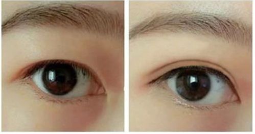 南昌做隆胸手術(shù)哪家好？選南昌最受歡迎的隆胸手術(shù)醫(yī)院有哪些