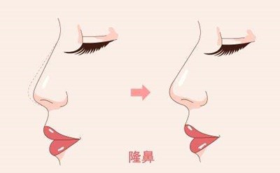 2023重慶膠原蛋白填充面部強(qiáng)榜前10名的專家(陳鵬、楊藝、蔣思軍這幾家技術(shù)高超價(jià)格低)