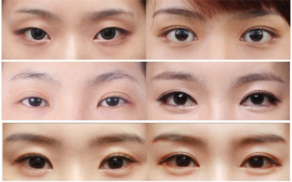 福州埋線(xiàn)減肥醫(yī)院哪家好？了解福州埋線(xiàn)減肥醫(yī)院的專(zhuān)業(yè)優(yōu)勢(shì)和患者評(píng)價(jià)