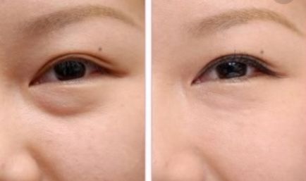 上海皮膚好的醫(yī)院有哪些？