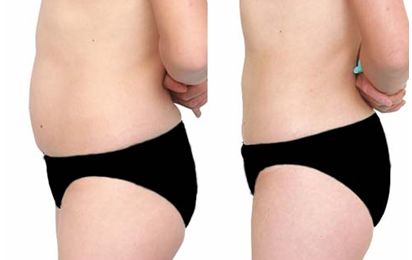 武漢哪家整形醫(yī)院的凸嘴技術(shù)好，值得信賴？