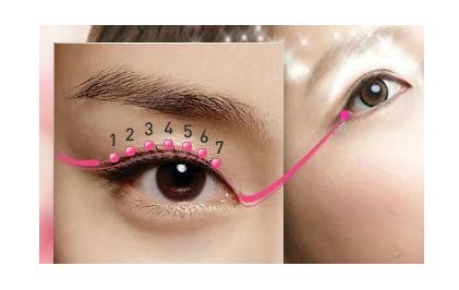 深圳埋線雙眼皮，哪家醫(yī)院技術(shù)好，效果持久？