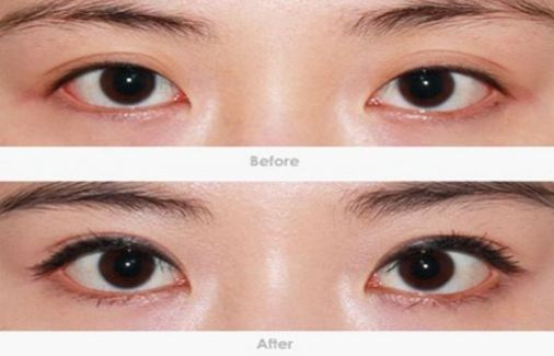 柳州哪家醫(yī)院做疤痕切除好？-獨(dú)家分享柳州疤痕切除醫(yī)院排行榜