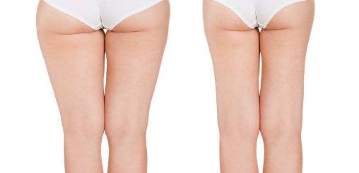 2023年西寧最受推薦的醫(yī)院紅血絲治療服務(wù)是哪家？