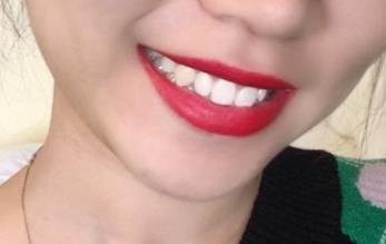 2023南京去除動(dòng)態(tài)細(xì)紋皺紋權(quán)威醫(yī)生排名榜前10強(qiáng)(高俠、左萍、張東獲好評(píng))