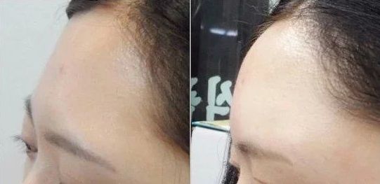 沈陽(yáng)私密整形去哪家好？專家推薦排行榜2023