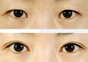 上海治療青春痘的專家推薦，哪家醫(yī)院效果最佳？