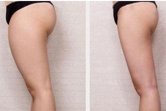 唐山哪家醫(yī)院整形科好？專家推薦，匯總唐山當?shù)乜诒罴颜吾t(yī)院