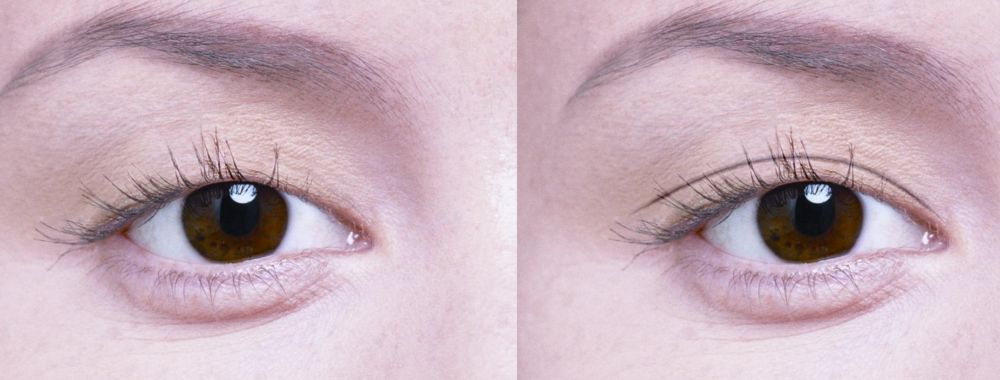 深圳鼻綜合整形哪家醫(yī)院好？完善整形美容的深圳專家醫(yī)院推薦