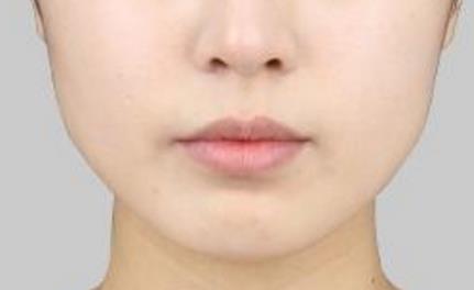 2023桂林光波祛眼袋排名榜前10強的醫(yī)生(李新華、亓發(fā)芝、鐘旭技術審美好、人氣很高！)