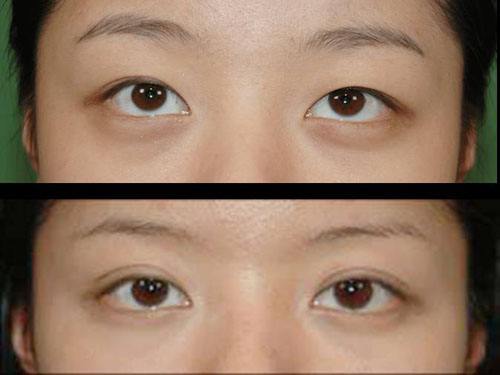 2023武漢冷凍法酒糟鼻治療top10的醫(yī)生(陳佳旭、馬超群、王介聰從實(shí)力看不輸公辦)