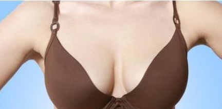 合肥藝星做美杜莎雙眼皮的價格是多少？