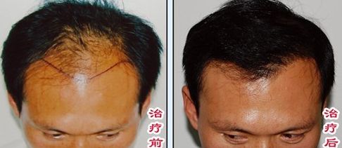 榆林醫(yī)專附屬醫(yī)院醫(yī)學整形美容中心怎么樣？榆林醫(yī)專附屬醫(yī)院醫(yī)學整形美容中心簡介|醫(yī)生團隊|口碑評價！