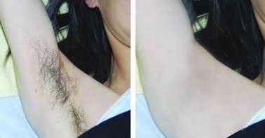 成都整下巴哪家醫(yī)院好，專家助你實現(xiàn)完美下巴線條