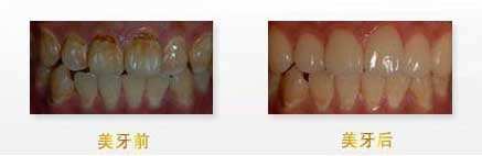 揭秘：武漢眼科醫(yī)生，他們的技術(shù)無人能敵！