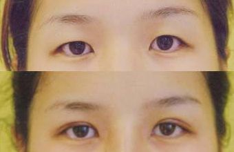 大慶微整形醫(yī)院哪家好？頂級專家為您解讀微整形醫(yī)院選擇指南！