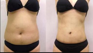 太原哪家醫(yī)院眼袋整形好？優(yōu)質(zhì)專家推薦